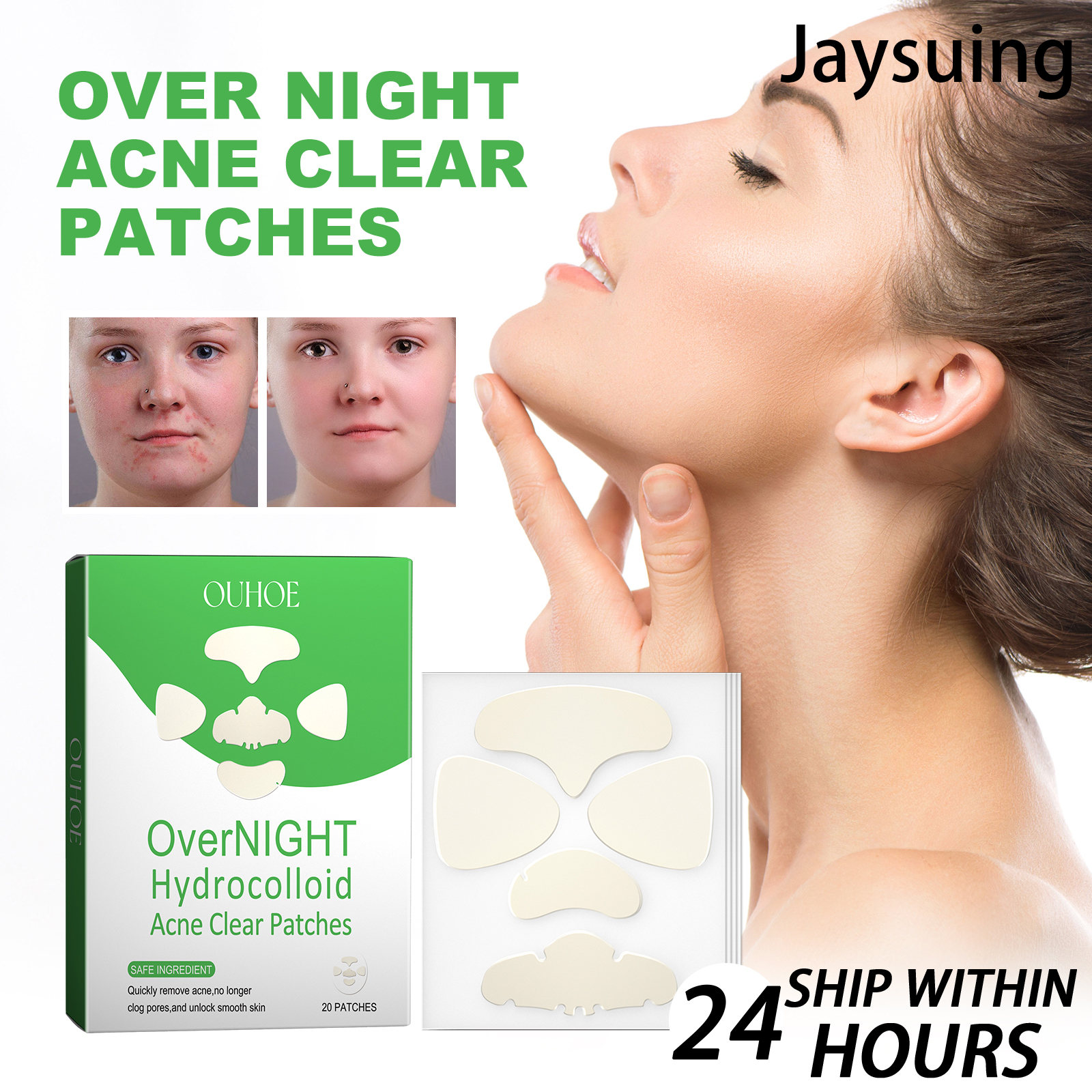 Tea Tree Spot Treatment - OUHOE Acne Patches for Face 20
