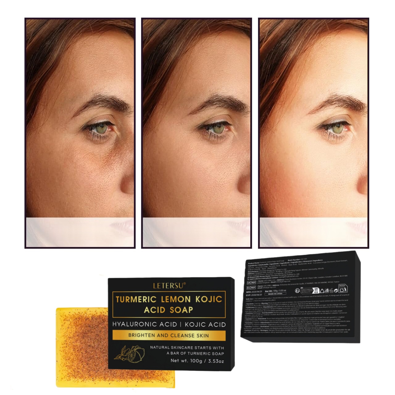 Turmeric Lemon Kojic Acid Soap - Kojic Acid Soap avis et prix