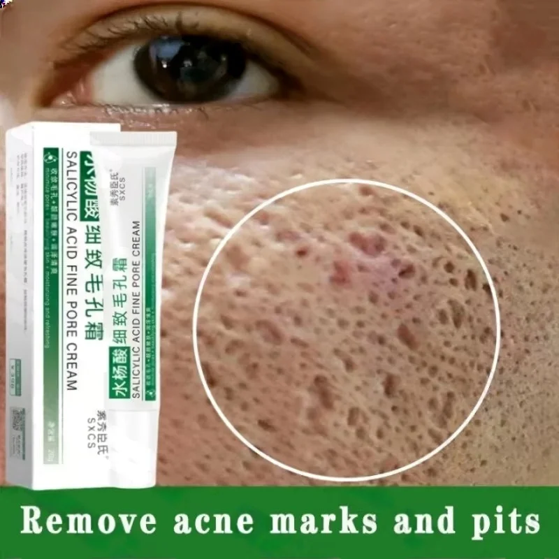 Salicylic Acid Pore Clearing C - Azelaic Acid Cream avis et prix