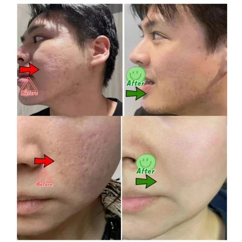 Salicylic Acid Pore Clearing C - Azelaic Acid Cream avis et prix