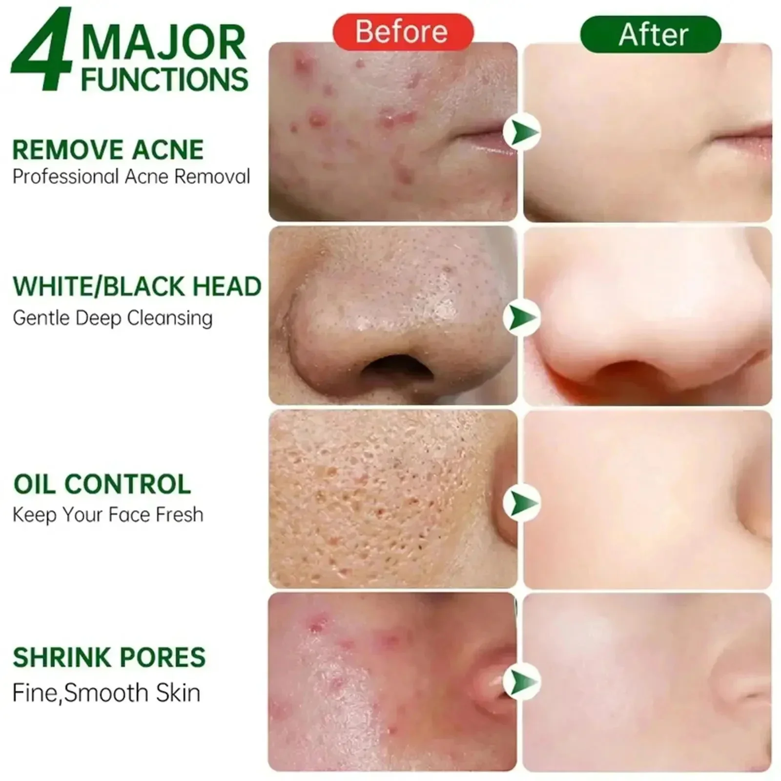 Salicylic Acid Pore Clearing C - Azelaic Acid Cream avis et prix