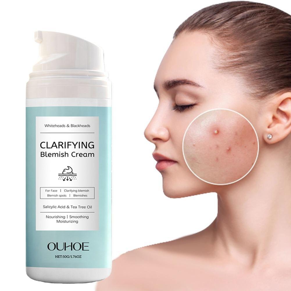 Salicylic Acid Facial Cream fo - Azelaic Acid Cream avis et prix