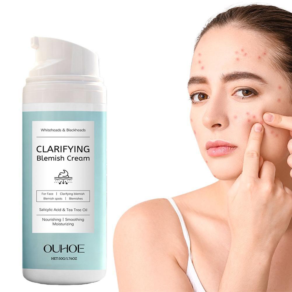 Salicylic Acid Facial Cream fo - Azelaic Acid Cream avis et prix