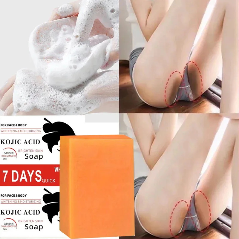 Kojic Acid Body Whitening Soap - Kojic Acid Soap avis et prix