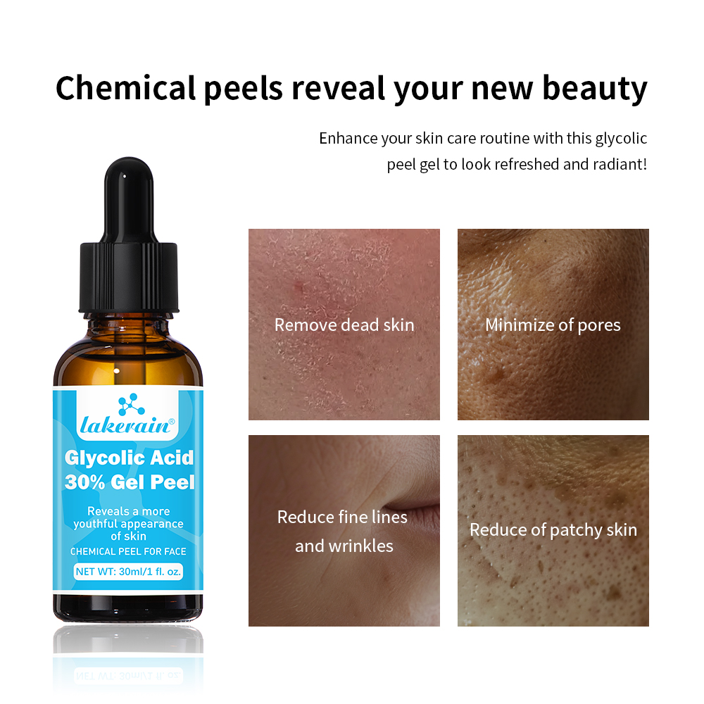 30% Glycolic Acid Peel Gel Pro - Lactic Acid Toner avis et prix