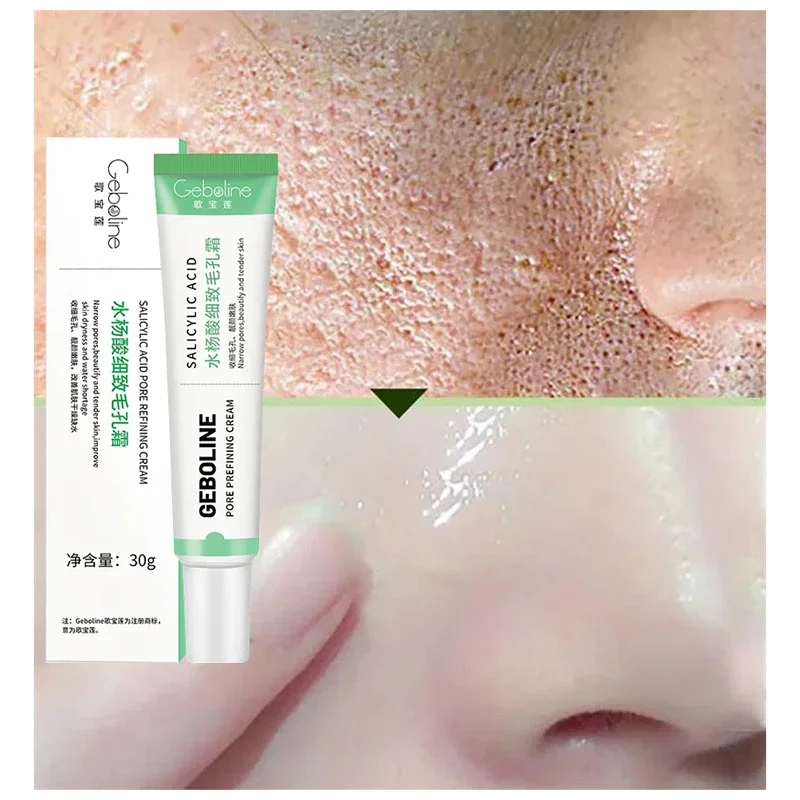 Salicylic Acid Pore Shrinking  - Azelaic Acid Cream avis et prix