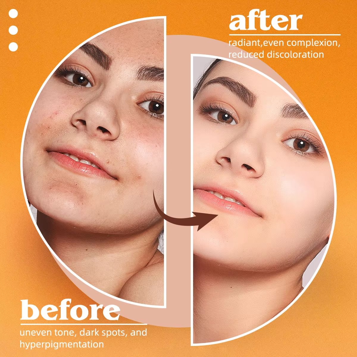 Kojic Acid Natural Papaya Soap - Kojic Acid Soap avis et prix