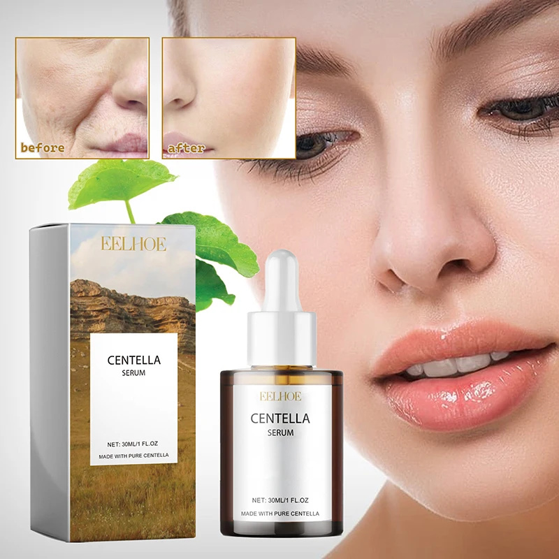 Centella Asiatica Face Serum N - Azelaic Acid Cream avis et prix