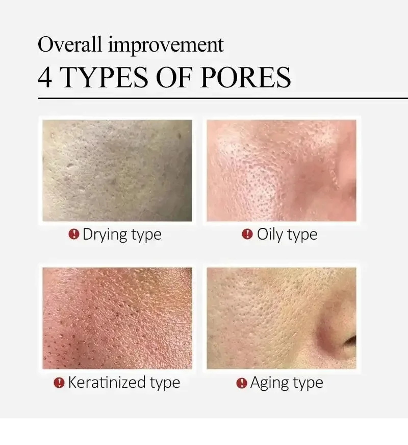 Centella Asiatica Shrink Pores - Lactic Acid Toner avis et prix