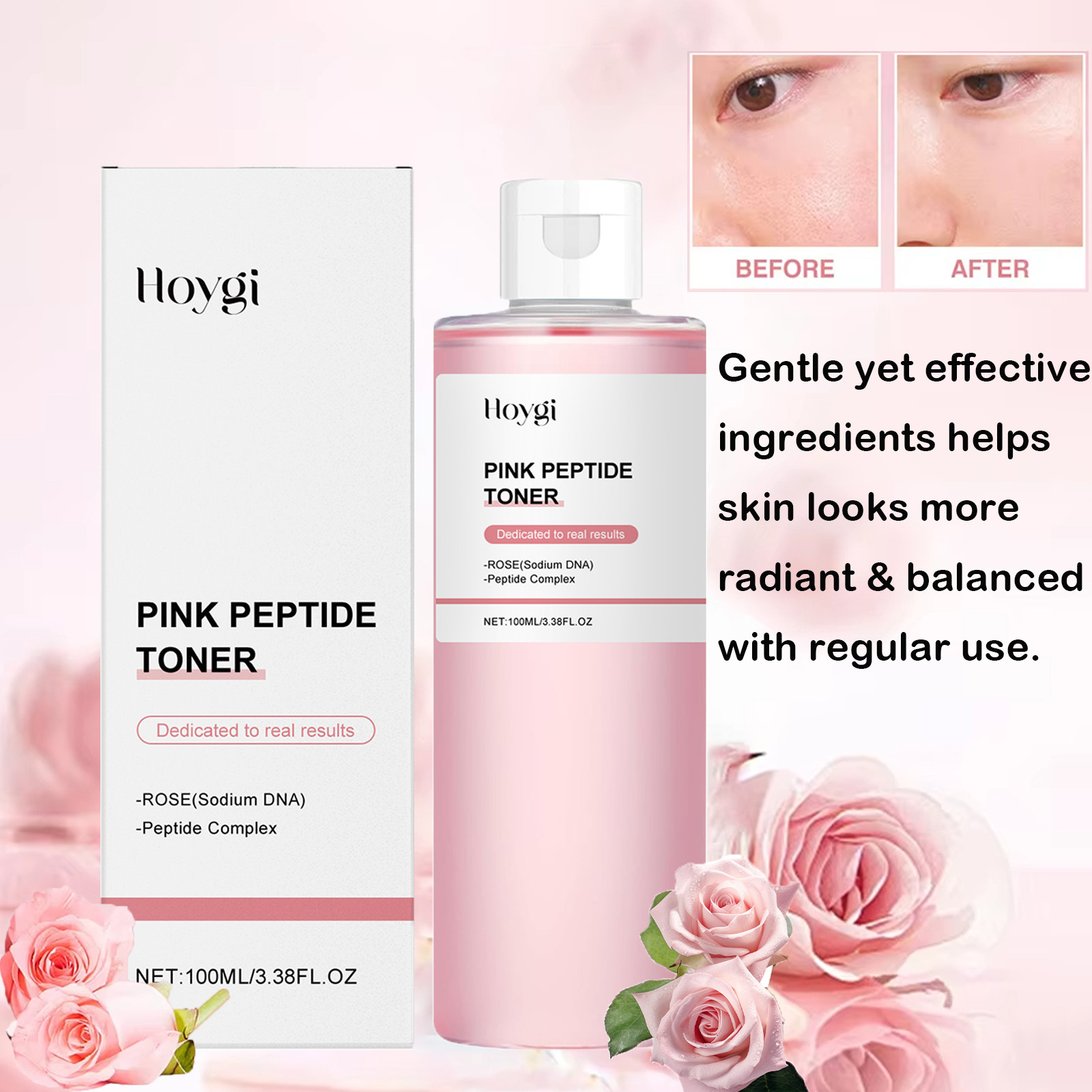 Rose Essence Toner Glowing Ski - Lactic Acid Toner avis et prix