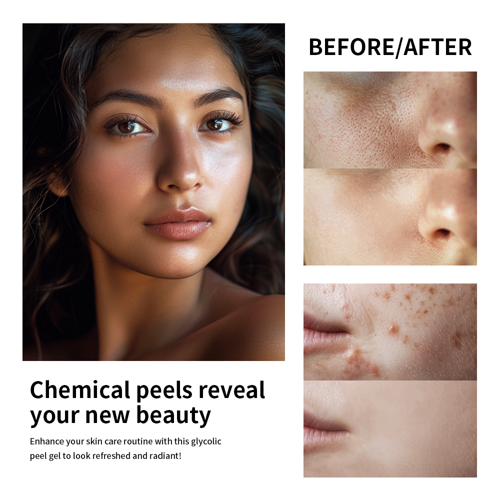30% Glycolic Acid Face Care Lo - Lactic Acid Toner avis et prix